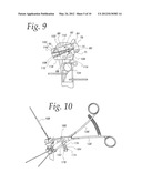 METHOD OF PERFORMING OSTEOTOMY diagram and image