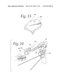 METHOD OF PERFORMING OSTEOTOMY diagram and image