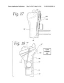 METHOD OF PERFORMING OSTEOTOMY diagram and image