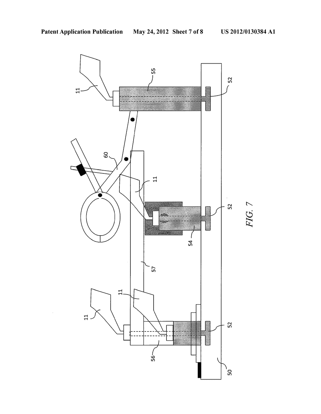 Apparatus for Osteotomy and Graft Preparation - diagram, schematic, and image 08