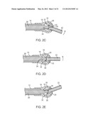 Insertion Handle For Surgical Implants diagram and image