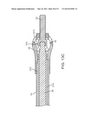 Insertion Handle For Surgical Implants diagram and image