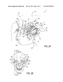 SYSTEMS AND METHODS FOR TREATMENT OF DRY EYE diagram and image