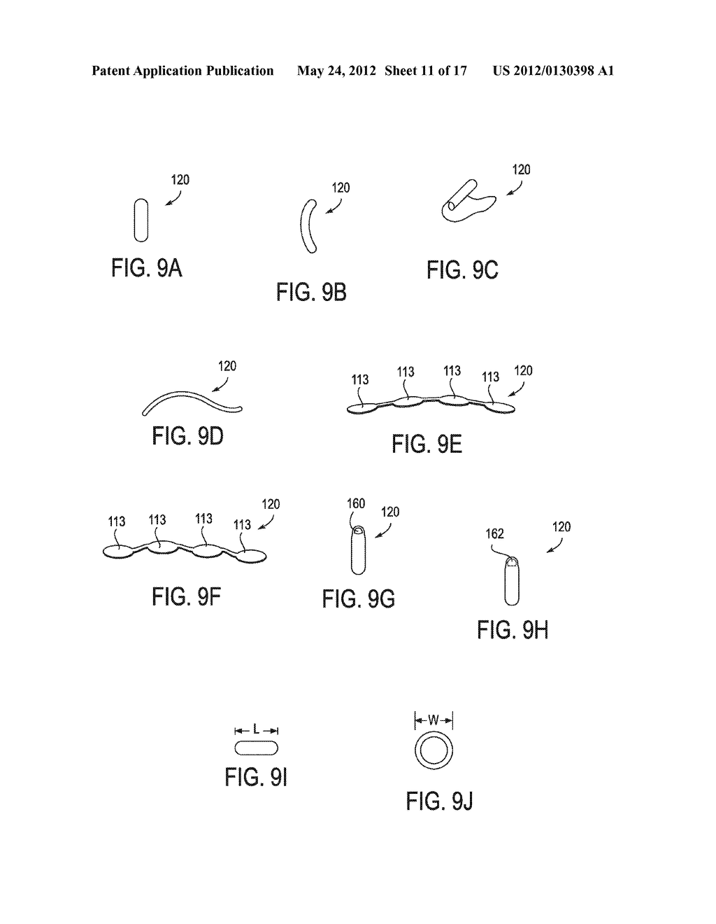 SYSTEMS AND METHODS FOR TREATMENT OF DRY EYE - diagram, schematic, and image 12