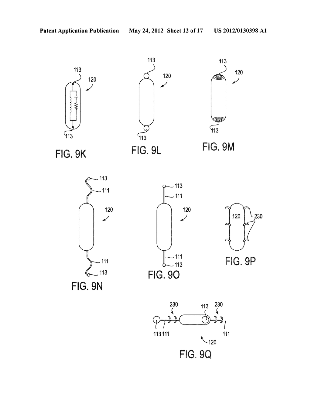 SYSTEMS AND METHODS FOR TREATMENT OF DRY EYE - diagram, schematic, and image 13