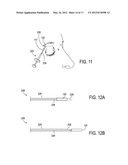 SYSTEMS AND METHODS FOR TREATMENT OF DRY EYE diagram and image