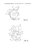 SYSTEMS AND METHODS FOR TREATMENT OF DRY EYE diagram and image