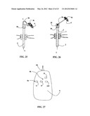 ERGONOMIC AND SEMI-AUTOMATIC MANIPULATOR, AND APPLICATIONS TO INSTRUMENTS     FOR MINIMALLY INVASIVE SURGERY diagram and image
