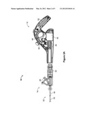 DIRECTION REVERSING VASCULAR TREATMENT DEVICE diagram and image