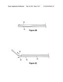 DIRECTION REVERSING VASCULAR TREATMENT DEVICE diagram and image