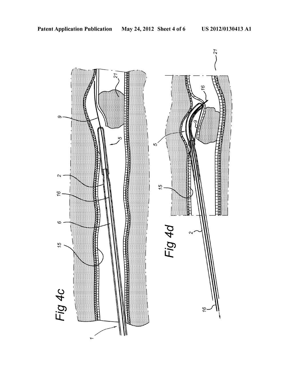 SURGICAL CUTTING INSTRUMENT - diagram, schematic, and image 05