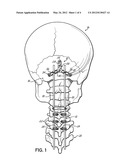 ADJUSTABLE OCCIPITAL PLATE diagram and image