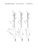 Bone Fixation Rod And Implantation Device For Insertion Thereof diagram and image