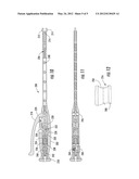 Bone Fixation Rod And Implantation Device For Insertion Thereof diagram and image
