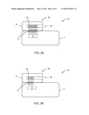 VARYING LEAD CONFIGURATION IMPLANTABLE MEDICAL DEVICE diagram and image