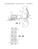 SYSTEM AND METHOD FOR DISPLAYING STIMULATION FIELD GENERATED BY ELECTRODE     ARRAY diagram and image