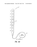 SYSTEM AND METHOD FOR DISPLAYING STIMULATION FIELD GENERATED BY ELECTRODE     ARRAY diagram and image