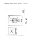 SYSTEM AND METHOD FOR DISPLAYING STIMULATION FIELD GENERATED BY ELECTRODE     ARRAY diagram and image