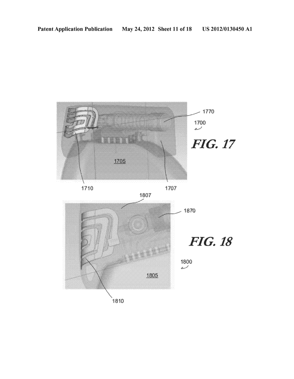 FOLDED ANTENNAS FOR IMPLANTABLE MEDICAL DEVICES - diagram, schematic, and image 12