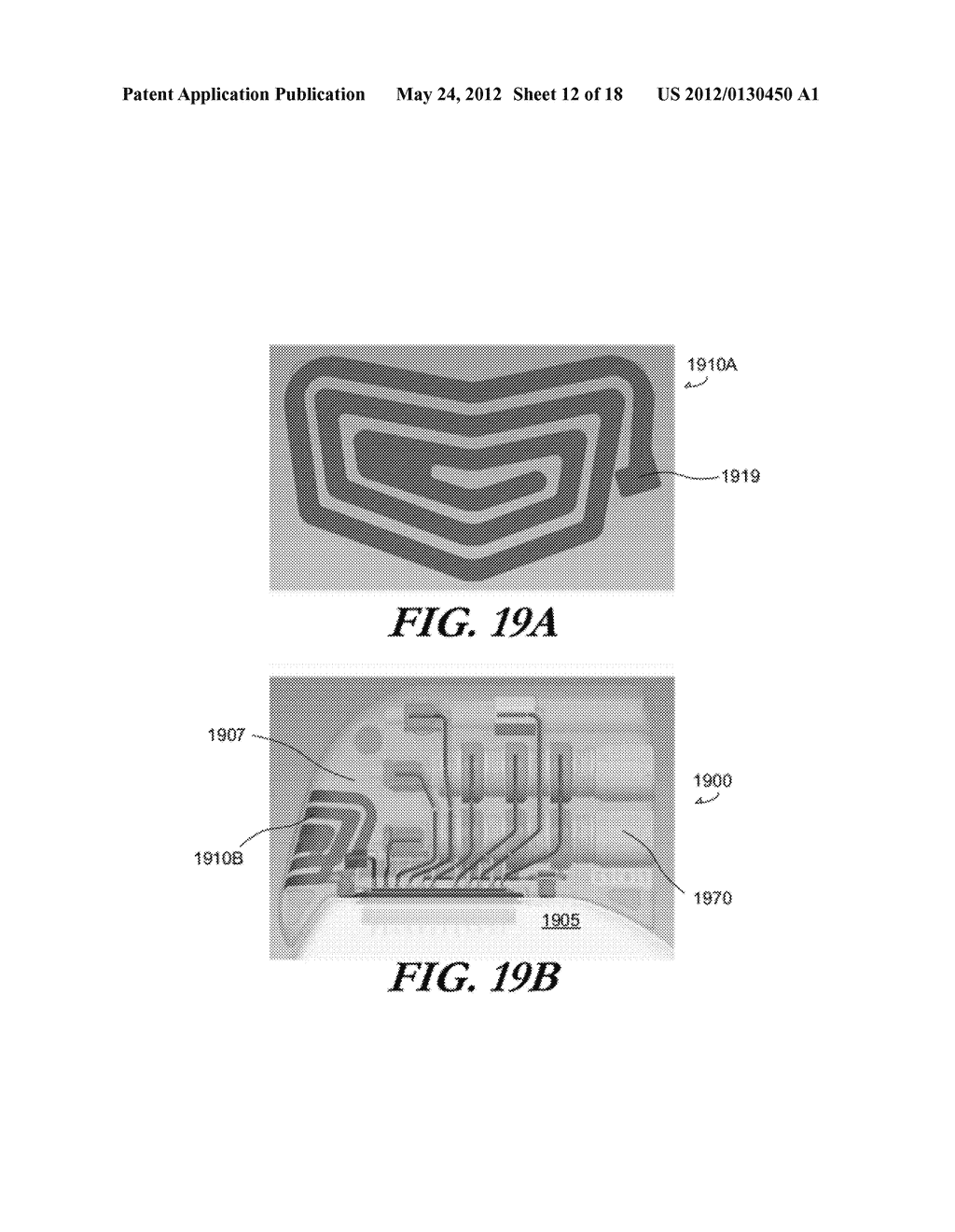 FOLDED ANTENNAS FOR IMPLANTABLE MEDICAL DEVICES - diagram, schematic, and image 13