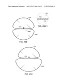 NEUROMODULATION CRYOTHERAPEUTIC DEVICES AND ASSOCIATED SYSTEMS AND METHODS diagram and image