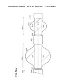 NEUROMODULATION CRYOTHERAPEUTIC DEVICES AND ASSOCIATED SYSTEMS AND METHODS diagram and image