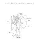 NEUROMODULATION CRYOTHERAPEUTIC DEVICES AND ASSOCIATED SYSTEMS AND METHODS diagram and image