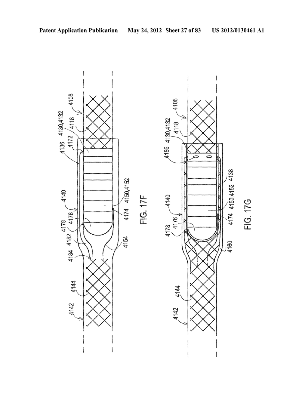 RADIOPAQUE MARKERS FOR IMPLANTABLE MEDICAL LEADS, DEVICES, AND SYSTEMS - diagram, schematic, and image 28