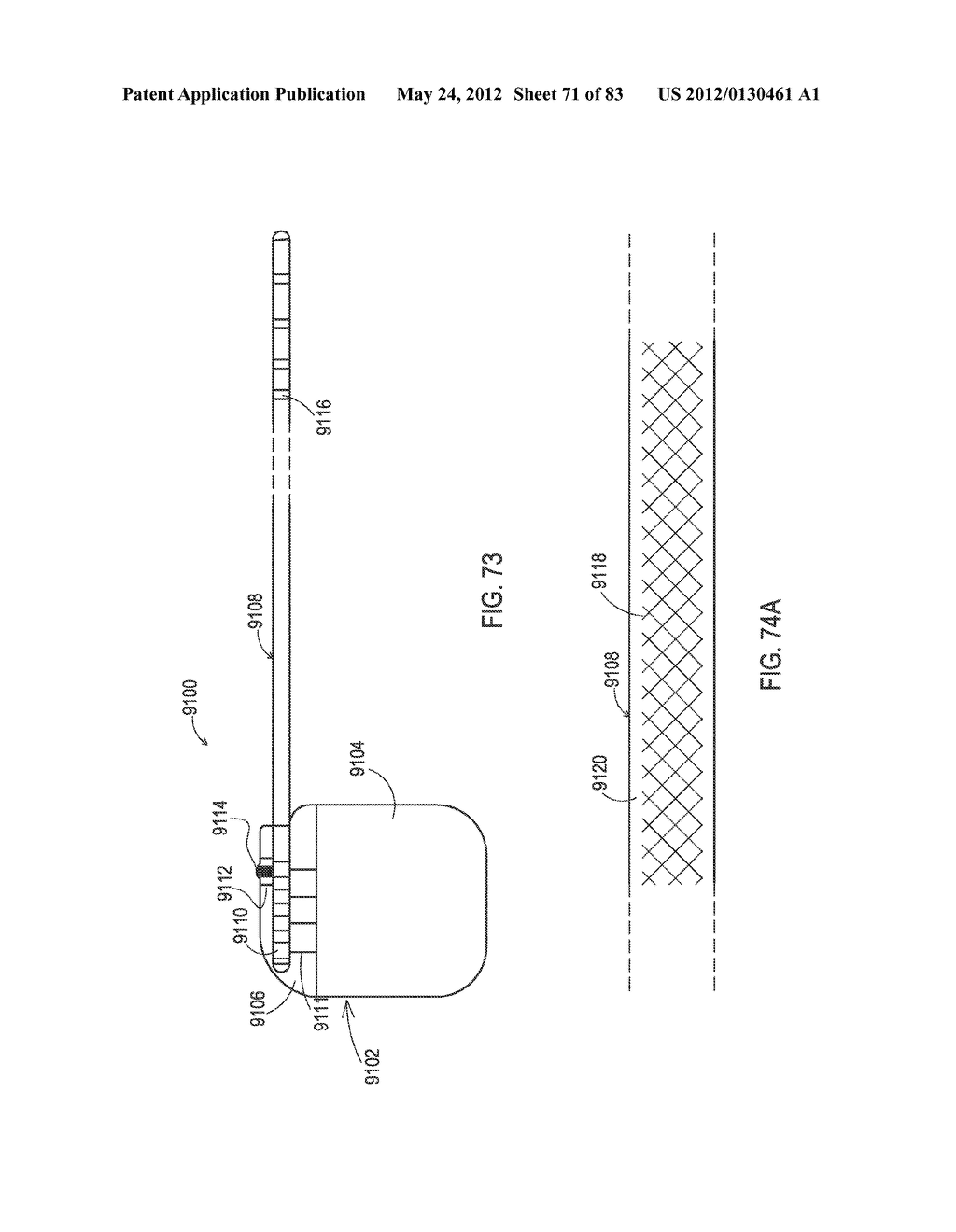 RADIOPAQUE MARKERS FOR IMPLANTABLE MEDICAL LEADS, DEVICES, AND SYSTEMS - diagram, schematic, and image 72