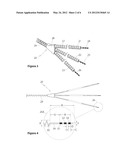 VESTIBULAR STIMULATION DEVICE diagram and image