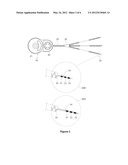 VESTIBULAR STIMULATION DEVICE diagram and image