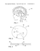 INTERFACIAL STENT AND METHOD OF MAINTAINING PATENCY OF SURGICAL     FENESTRATIONS diagram and image