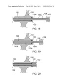 INTERFACIAL STENT AND METHOD OF MAINTAINING PATENCY OF SURGICAL     FENESTRATIONS diagram and image