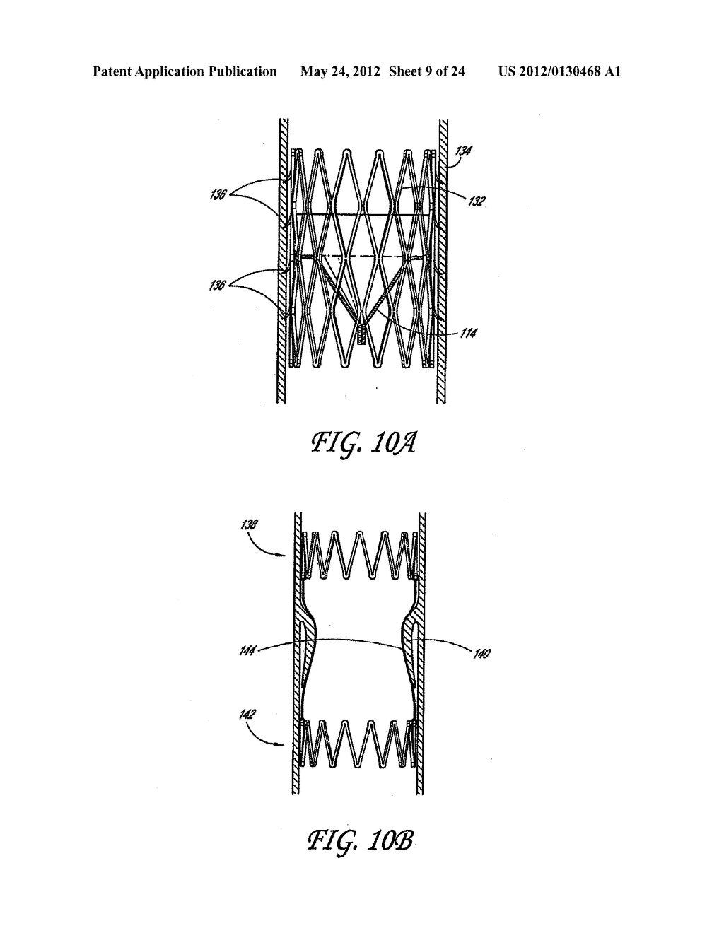 METHODS AND APPARATUS FOR TREATING NEUROVASCULAR VENOUS OUTFLOW     OBSTRUCTION - diagram, schematic, and image 10