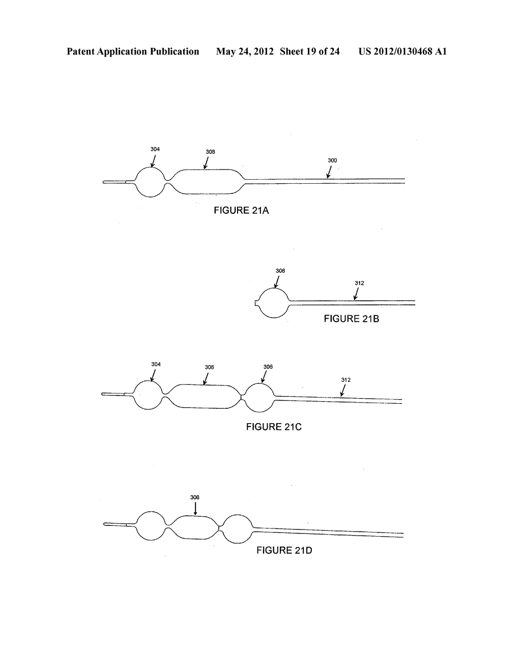 METHODS AND APPARATUS FOR TREATING NEUROVASCULAR VENOUS OUTFLOW     OBSTRUCTION - diagram, schematic, and image 20