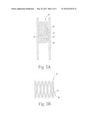 STENT WITH PROTECTED BARBS diagram and image