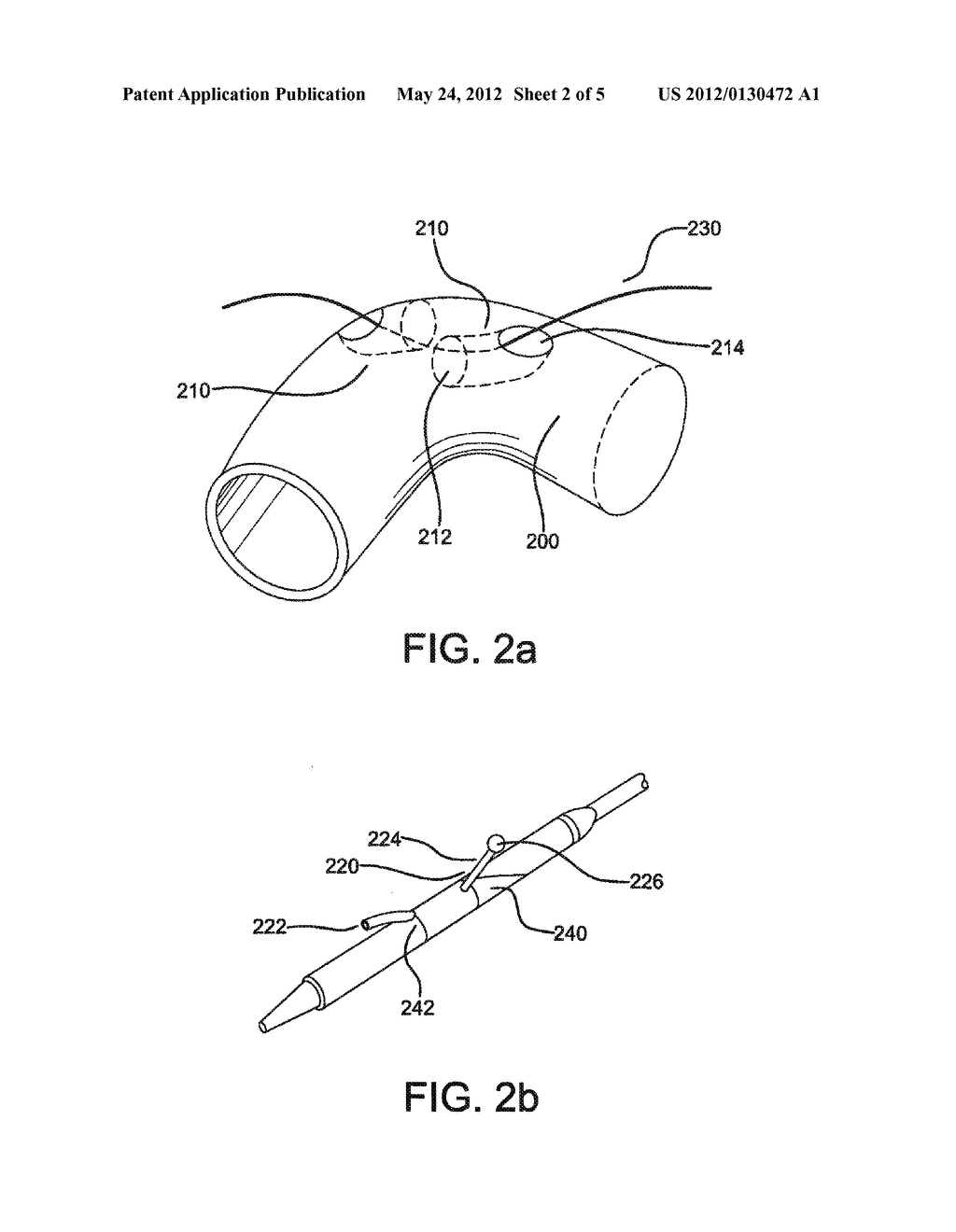 STENT-GRAFT HAVING FACING SIDE BRANCH PORTALS - diagram, schematic, and image 03