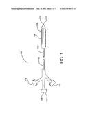 DEPLOYMENT OF ENDOLUMINAL DEVICES diagram and image