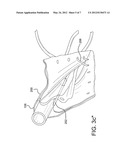 DEPLOYMENT OF ENDOLUMINAL DEVICES diagram and image