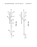 DEPLOYMENT OF ENDOLUMINAL DEVICES diagram and image