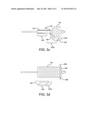 DEPLOYMENT SLEEVE SHORTENING MECHANISM diagram and image