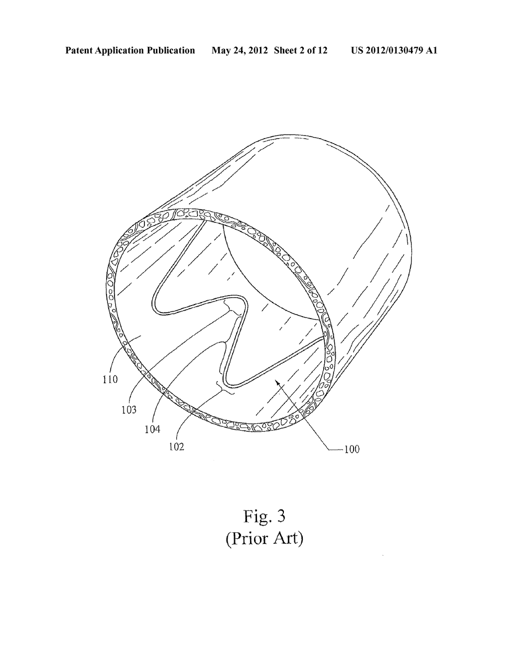 LOW PROFILE NON-SYMMETRICAL STENTS AND STENT-GRAFTS - diagram, schematic, and image 03