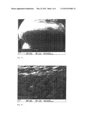 TUBULAR IMPLANT FOR REPLACING NATURAL BLOOD VESSELS diagram and image