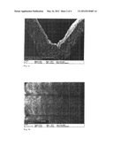 TUBULAR IMPLANT FOR REPLACING NATURAL BLOOD VESSELS diagram and image