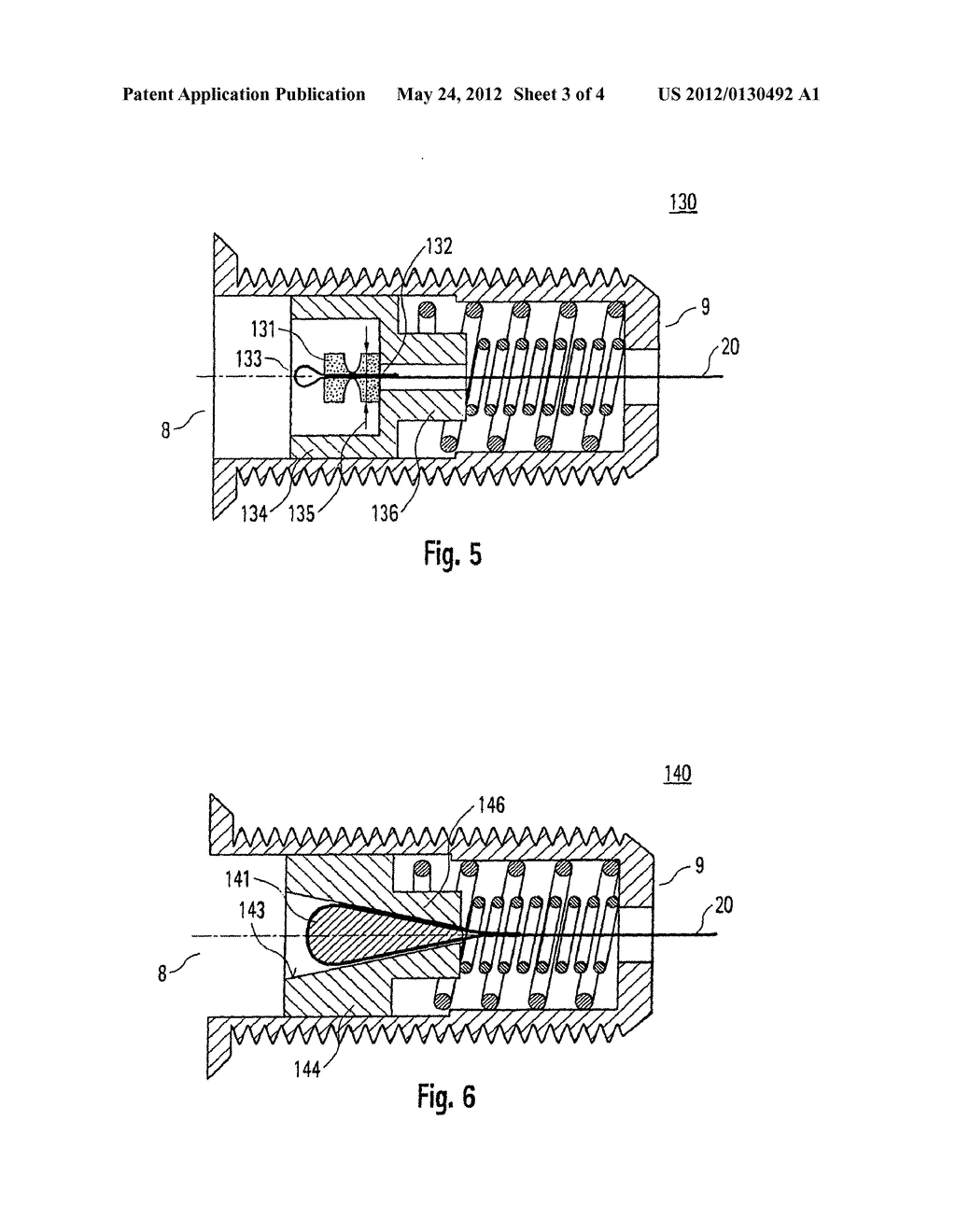 IMPLANTABLE SYSTEM HAVING A DISSOLUTION MECHANISM UPON RECOVERY - diagram, schematic, and image 04