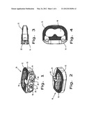 Intervertebral Fusion Implant diagram and image