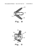 Intervertebral Fusion Implant diagram and image