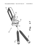 Intervertebral Fusion Implant diagram and image