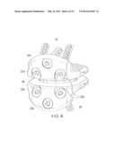 Arthroplasty spinal prosthesis and insertion device diagram and image