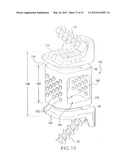 Arthroplasty spinal prosthesis and insertion device diagram and image